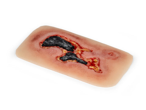 Rană simulator ulcer arterial la picior, mic, faza de exudare