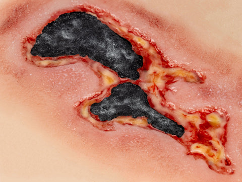 Rană simulator ulcer arterial la picior, mic, faza de exudare