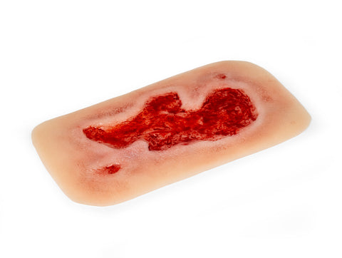 Rană simulator ulcer arterial la picior, mic, faza de granulație