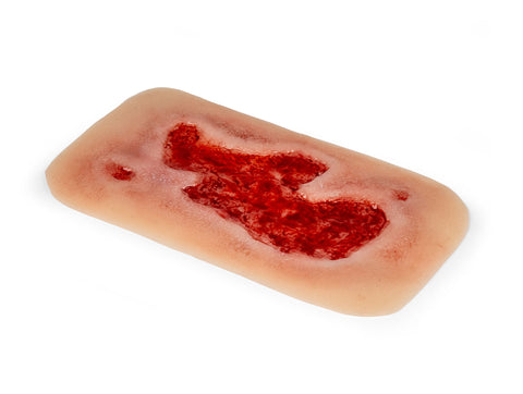 Rană simulator ulcer arterial la picior, mic, faza de granulație