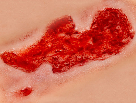 Rană simulator ulcer arterial la picior, mic, faza de granulație