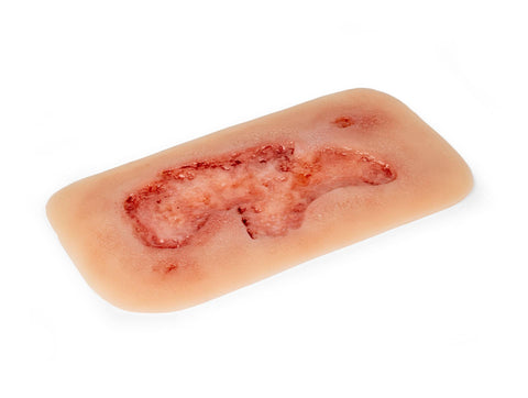 Rană simulator ulcer arterial la picior, mic, faza de epitelizare