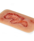 Rană simulator ulcer arterial la picior, mic, faza de epitelizare