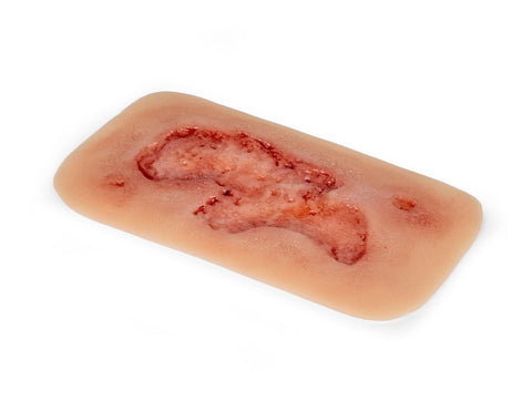 Rană simulator ulcer arterial la picior, mic, faza de epitelizare
