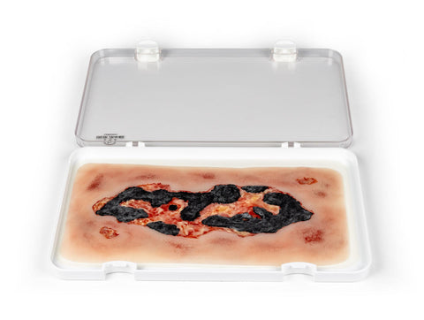 Rană simulator ulcer arterial la picior, mare, faza de exudare