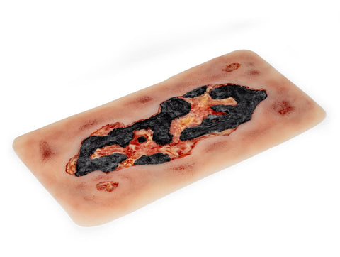 Rană simulator ulcer arterial la picior, mare, faza de exudare