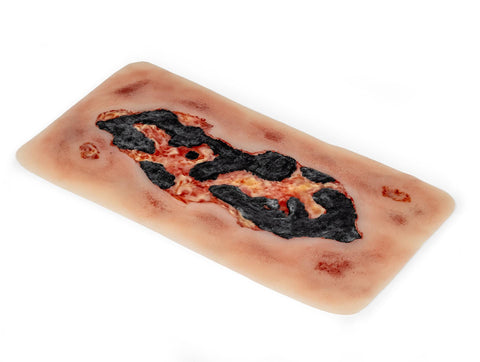 Rană simulator ulcer arterial la picior, mare, faza de exudare