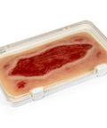 Moulage ulcer arterial la picior, mare, fază de granulație
