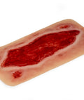 Moulage ulcer arterial la picior, mare, fază de granulație