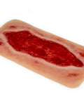Moulage ulcer arterial la picior, mare, fază de granulație