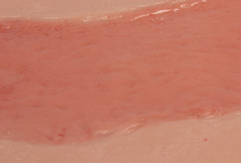 Rană simulator ulcer arterial la picior, mare, faza de epitelizare