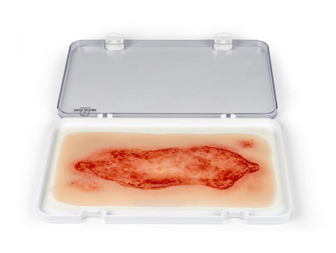 Rană simulator ulcer arterial la picior, mare, faza de epitelizare