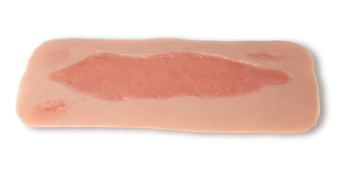 Rană simulator ulcer arterial la picior, mare, faza de epitelizare