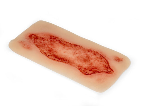 Rană simulator ulcer arterial la picior, mare, faza de epitelizare