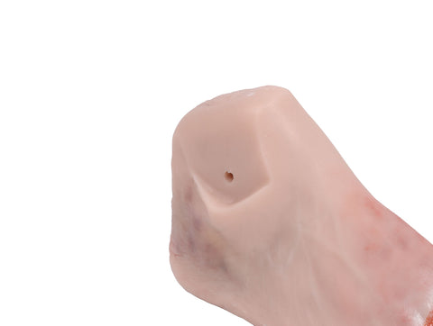 Picior rană cu sindromul piciorului diabetic, stadiu avansat, versiune manechin