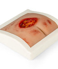Moulage rană decubit sacral, curățat, inclus stand