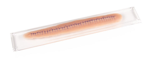 Surgical wound, with suture, 22cm