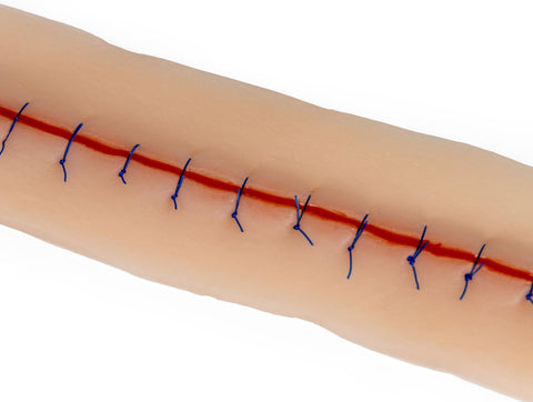Rană chirurgicală, cu sutură, 22cm