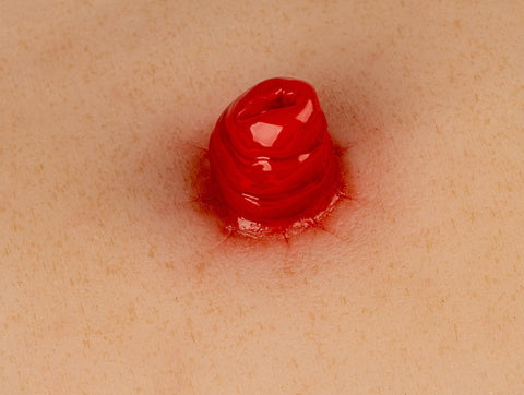 Moulage rană ileostomă, inclus stand
