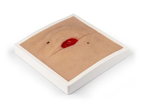 Moulage rană colostomă în pliu abdominal, inclus stand