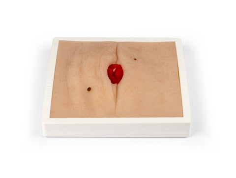 Moulage rană colostomă în pliu abdominal, inclus stand