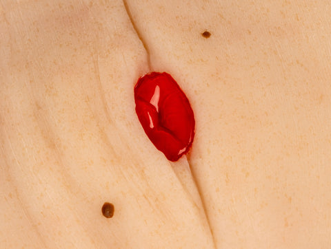 Moulage rană colostomă în pliu abdominal, inclus stand