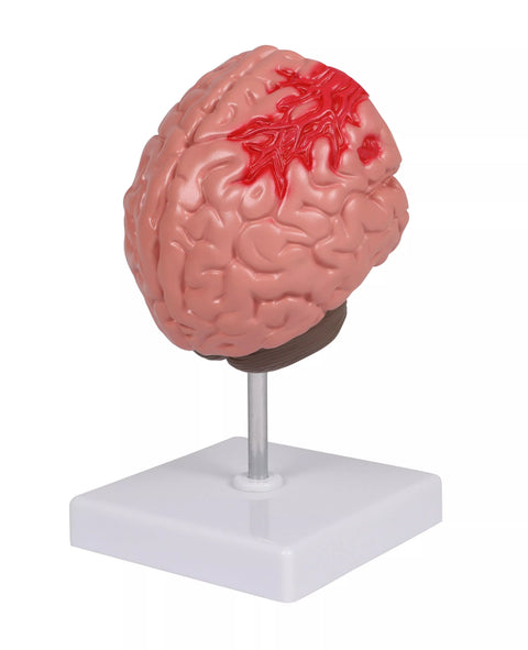 Patologii cerebrale