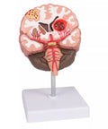 Patologii cerebrale