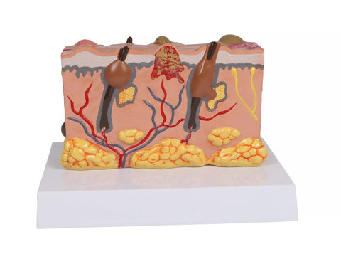 Model piele patologic