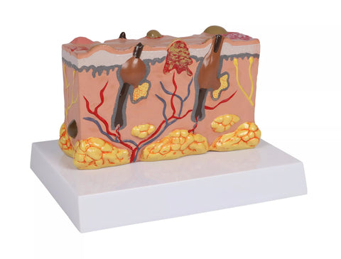 Model piele patologic