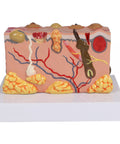 Model piele patologic
