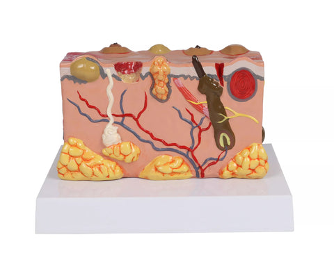 Model piele patologic