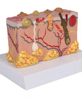 Model piele patologic