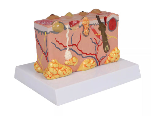 Model piele patologic