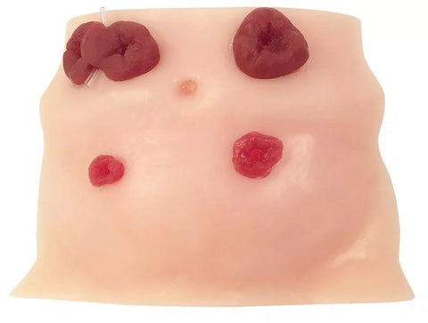 Model îngrijire ostomie