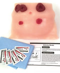 Model îngrijire ostomie