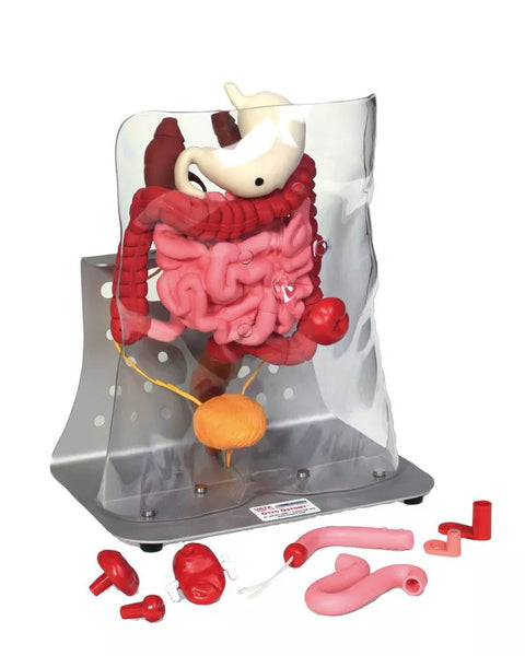 Otto Ileostomie/Colostomie Avansat