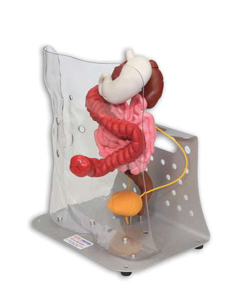Otto ileostomie/colostomie avansat
