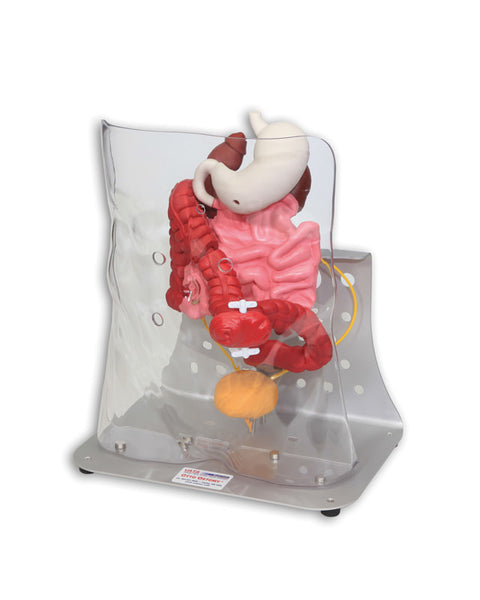 Otto ileostomie/colostomie avansat