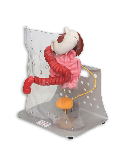 Otto ileostomie/colostomie avansat