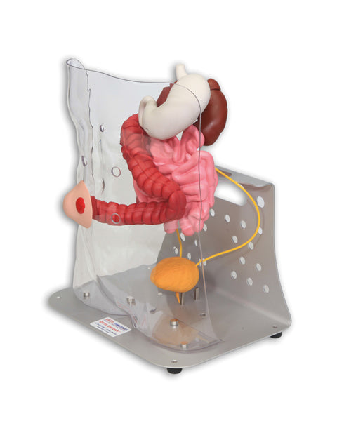 Otto ileostomie/colostomie avansat
