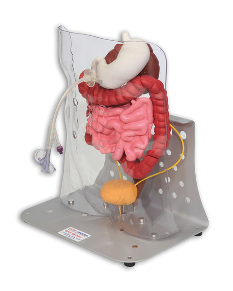 Otto ileostomie/colostomie avansat