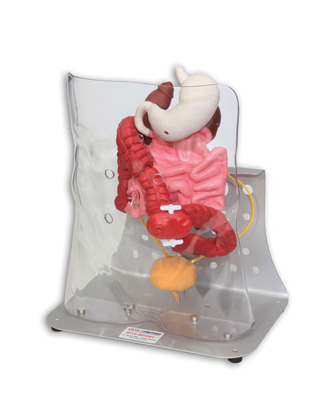 Otto ileostomie/colostomie avansat
