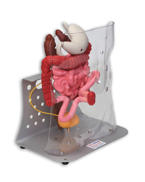 Otto ileostomie/colostomie avansat