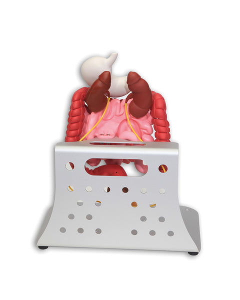 Otto ileostomie/colostomie avansat