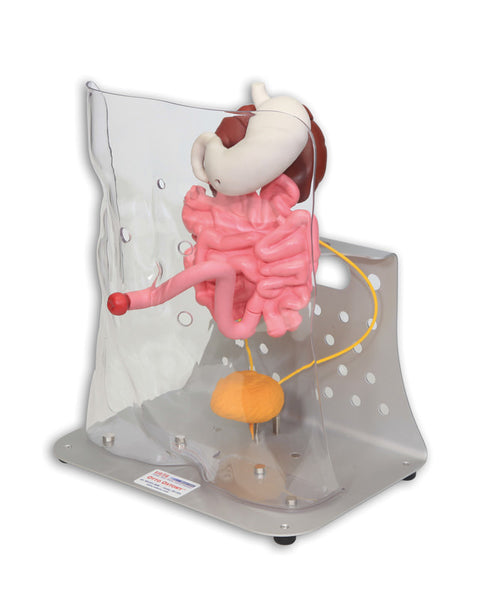 Otto ileostomie/colostomie avansat