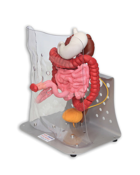 Otto ileostomie/colostomie avansat