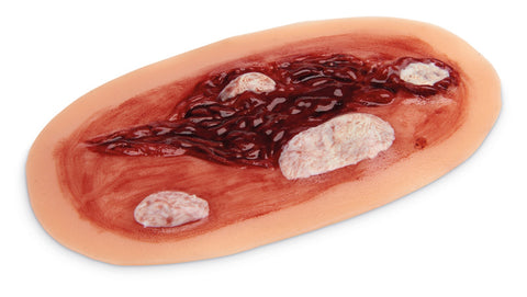 Kit moulage îngrijire medicală