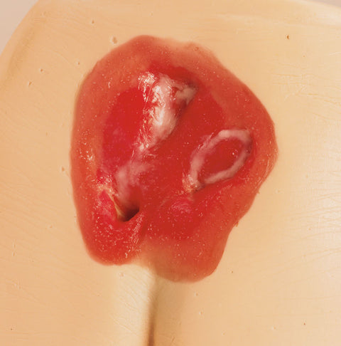 Modele de ulcer de presiune / plagă de pat
