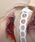 Casualty Care Rescue Randy